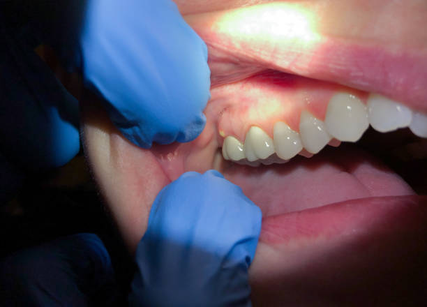 Best Emergency Dentist for Special Needs Patients in North Scituate, MA