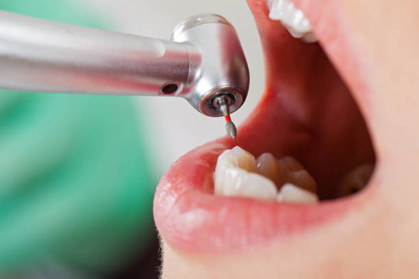 Best Weekend Emergency Dentist in North Scituate, MA